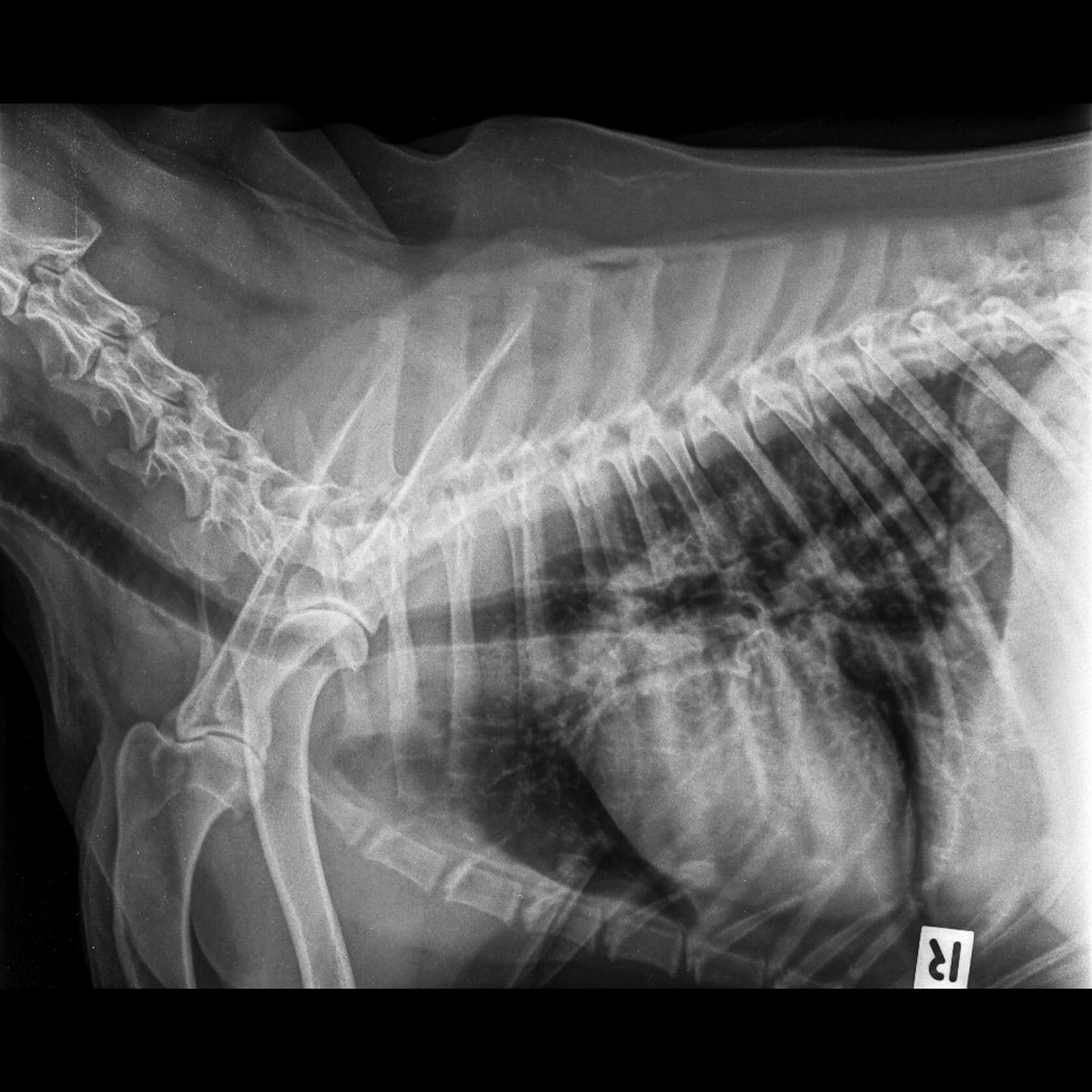 X-Ray Radiograph